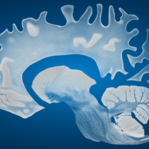 Cuidar amb dignitat: Alzheimer Catalunya Fundació i els reptes de la demència